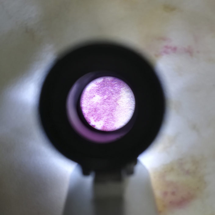 Microorganismos visibles al microscopio